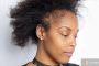 What You Should Know About Alopecia