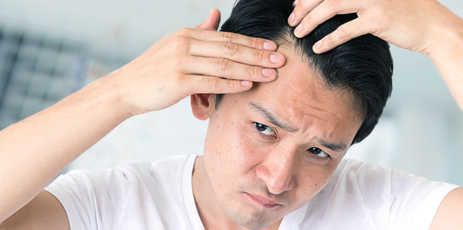 Hair Loss in Men | Male Hair Loss | Cranial Prosthesis Center